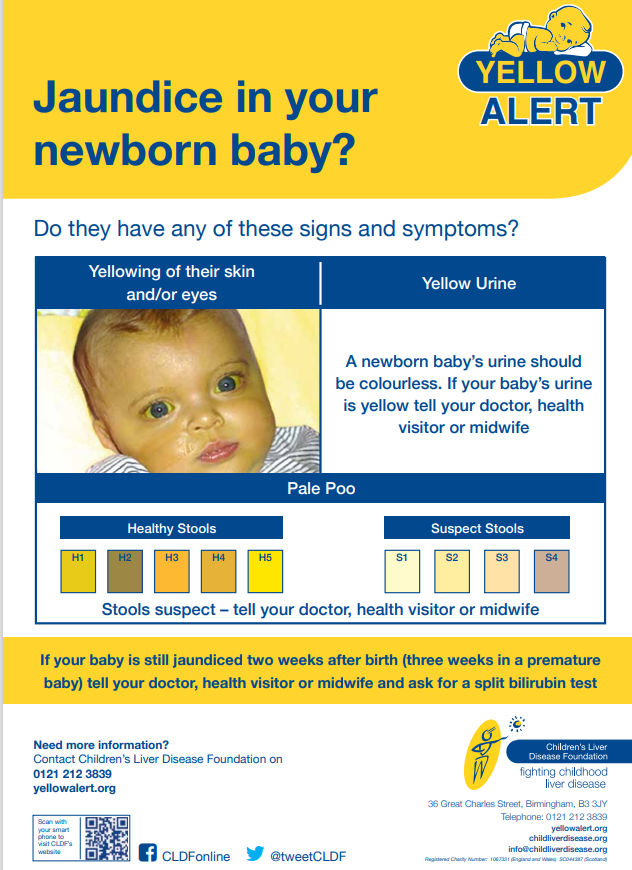 Jaundice In Newborn Babies Cardiff South Wales Cluster
